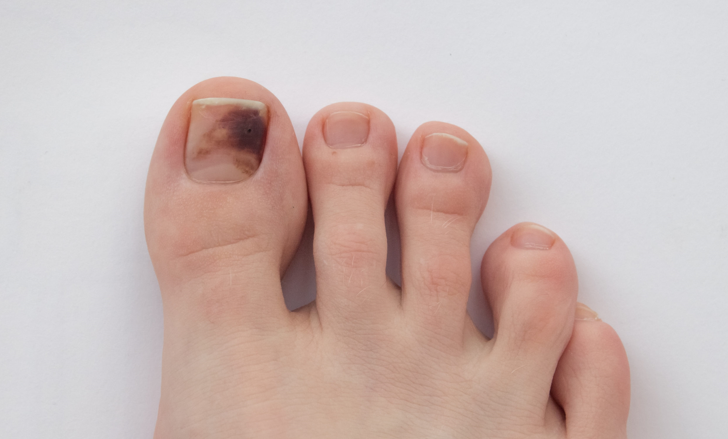 foot nail color for dark skin