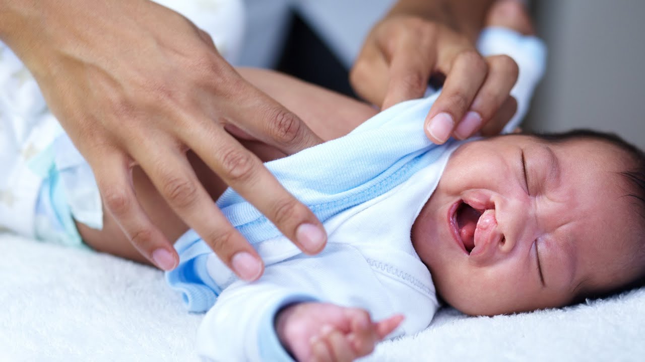 Cleft Palate symptoms pictures