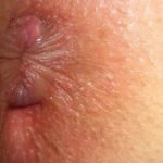 Piles starting stage pictures