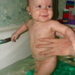 Chicken pox 1 year old pictures