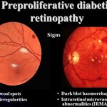 Diabetic retinopathy images