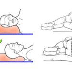 How to sleep with cervical osteochondrosis pictures