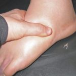 Blood clot in toe pictures