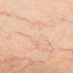 Pictures of veins