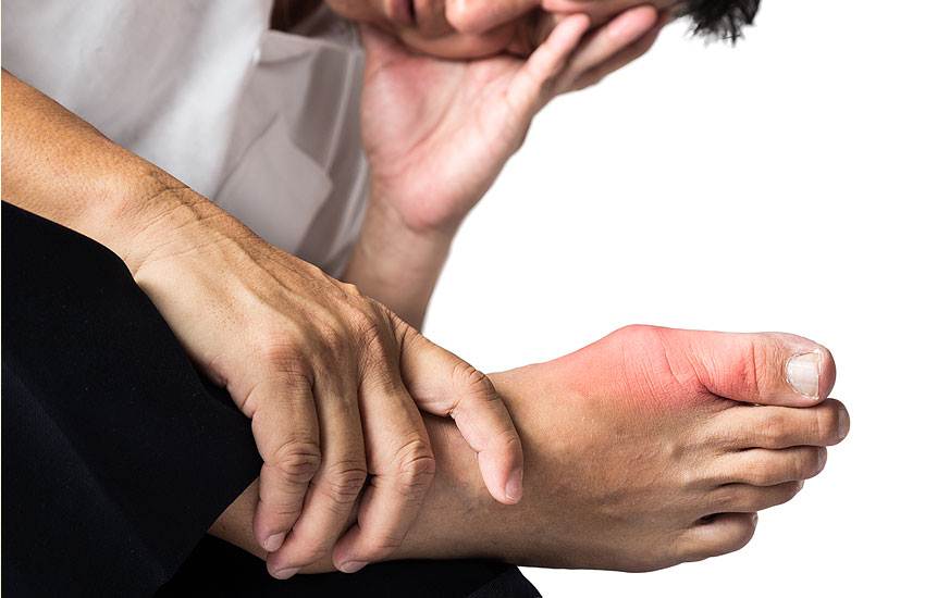 Symptoms of gout pictures