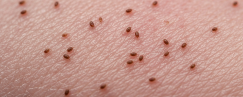 What does Demodicosis look like symptoms pictures