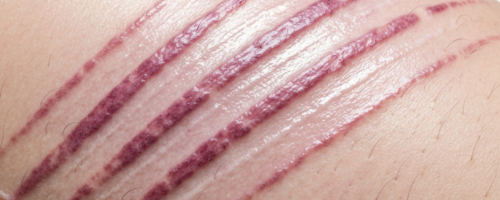 Marfan syndrome symptoms pictures