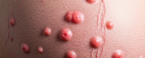 12 weeks pregnant symptoms pictures