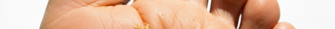 Symptoms and pictures