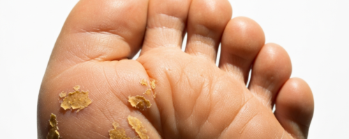 Periodontitis symptoms pictures
