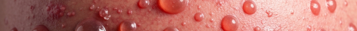 Symptoms and pictures