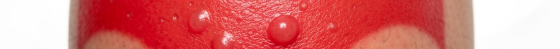 Symptoms and pictures