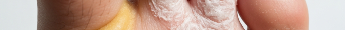Symptoms and pictures