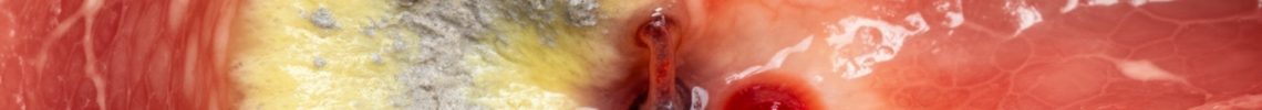 Symptoms and pictures