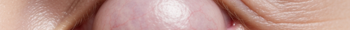 Symptoms and pictures
