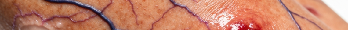Symptoms and pictures