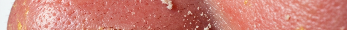Symptoms and pictures