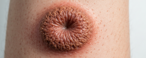 squamous cell carcinoma symptoms pictures