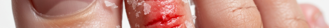 Symptoms and pictures