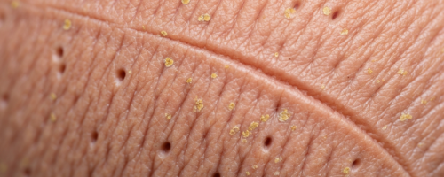diathesis symptoms pictures